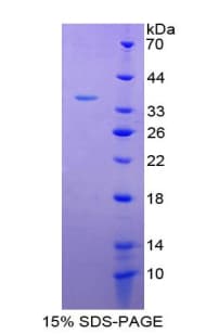 Rat IL4 Protein (Recombinant His-GST)