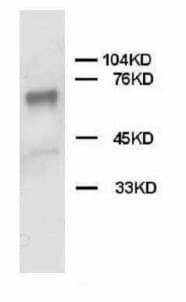 PTPN11 / SHP-2 / NS1 Antibody (C-Terminus)