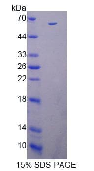 Pig IL12B / IL12 p40 Protein (Recombinant His-GST)