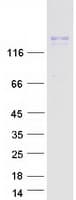 Human INSRR Protein (Recombinant Myc-DDK (Flag))