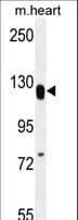 Polyclonal Rabbit anti-Human MED14 Antibody (aa586-615, WB)