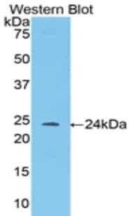 ANGPT1 / Angiopoietin-1 Antibody (aa35-231)