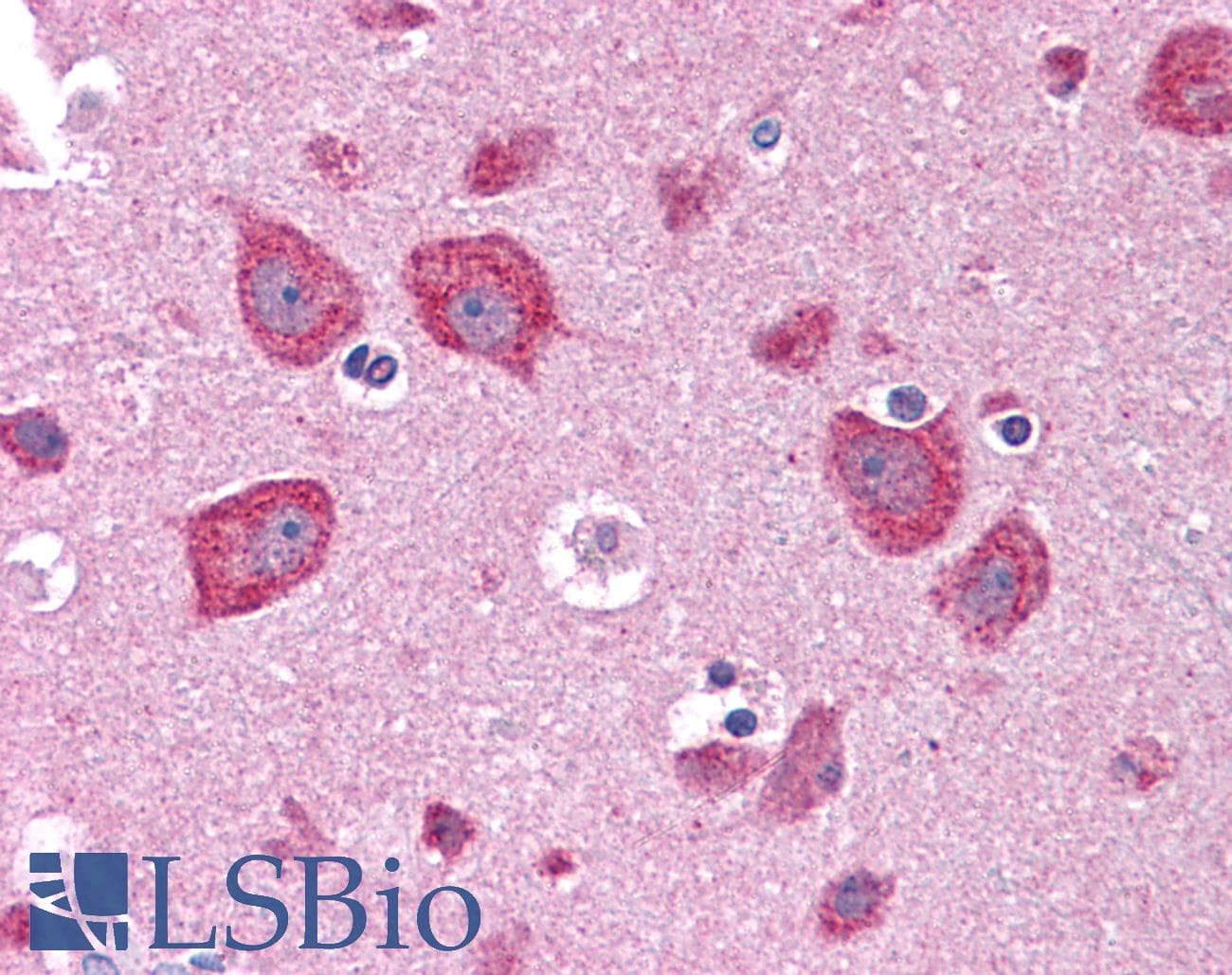 IHC-plus™ DKK3 Antibody (aa340-350)