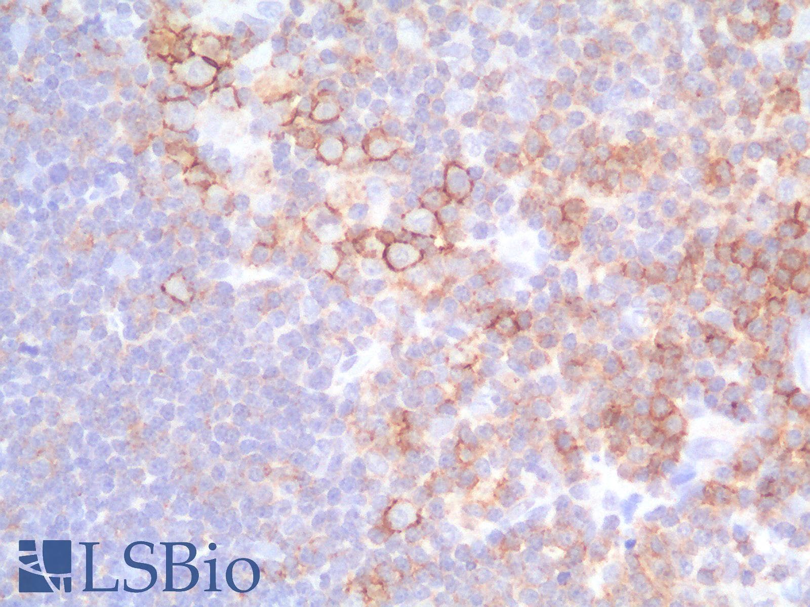 PathPlus™ SPN / CD43 Antibody (clone SPN/1766R)