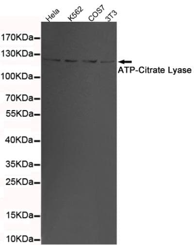 Monoclonal Mouse anti-Human ACLY / ATP Citrate Lyase Antibody (WB)