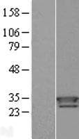TXNDC9 Protein (Over-Expression Lysate Myc-DDK (Flag))