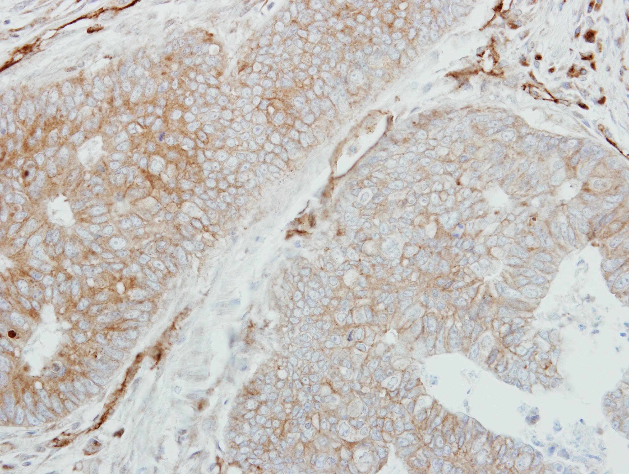 HLA-DMB Antibody (aa199-263)