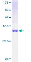 Human TRAPPC2 / SEDL Protein (Recombinant GST)