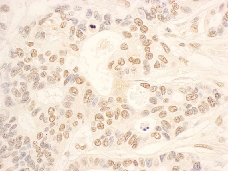 NOP58 / NOP5 Antibody (aa479-529)