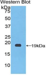 F8 / FVIII / Factor VIII Antibody (aa1887-2044)