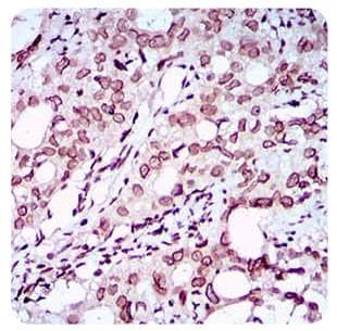 ZEB1 / AREB6 Antibody (aa800-1124, clone 2A8A6)