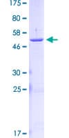 Human KLK2 / Kallikrein 2 Protein (Recombinant GST)