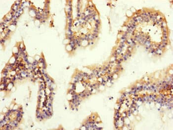 Polyclonal Rabbit anti-Human GNB2 Antibody (IHC, WB)