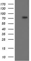 RIPK1 / RIP Antibody (aa133-422, clone OTI2D6, Carrier-free)