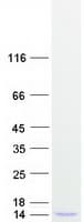 Human IL8 / Interleukin 8 Protein (Recombinant Myc-DDK (Flag))