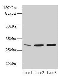 RAP30 / GTF2F2 Antibody