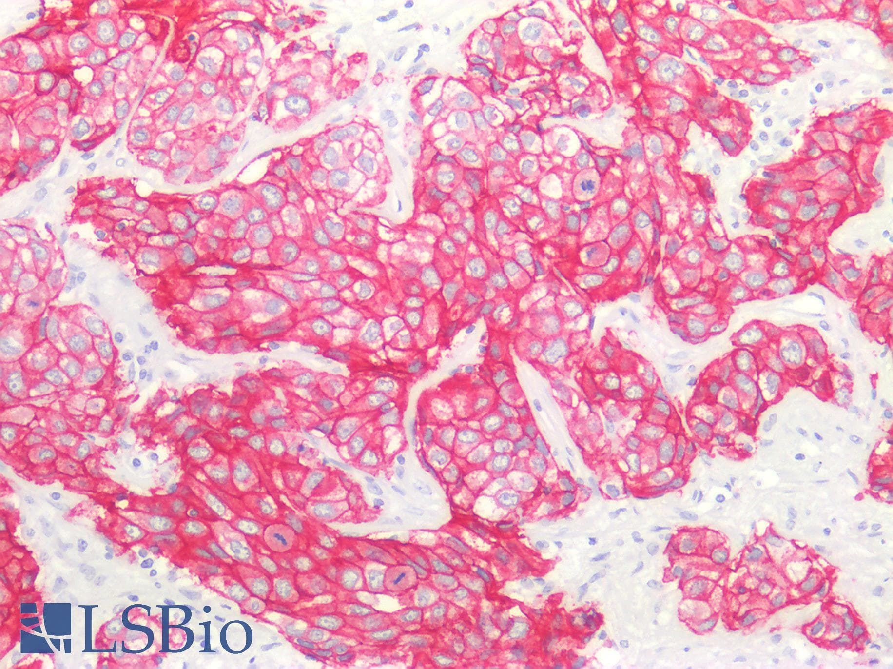 PathPlus™ Monoclonal Mouse anti-Human ERBB2 / HER2 Antibody (Concentrated, IHC, WB)
