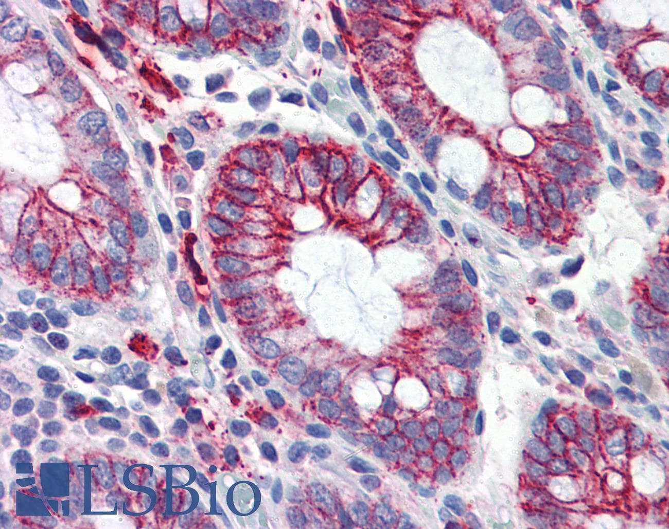 IHC-plus™ Monoclonal Mouse anti-Human ITGB1 / Integrin Beta 1 / CD29 Antibody (clone K2D5, aa34-141, IHC, WB)