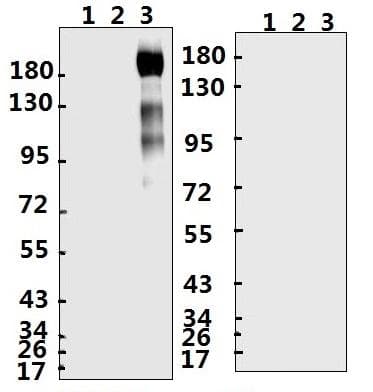 SARS-CoV-2 Spike Glycoprotein Antibody (aa 76-89)