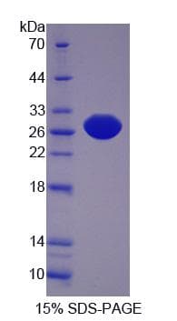 Human PCMT1 Protein (Recombinant His-S)