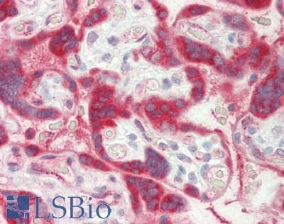 IHC-plus™ TGM2 / Transglutaminase 2 Antibody (aa1-50)