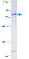 Human POC1A / SOFT Protein (Recombinant GST)