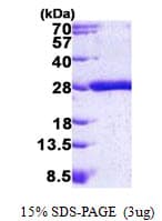 Human KRAS Protein (Recombinant His)