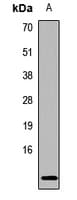 HBE1 / Hemoglobin Epsilon 1 Antibody