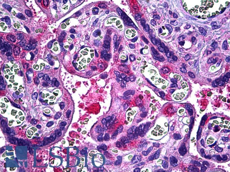 IHC-plus™ DIAPH2 Antibody (aa56-114)