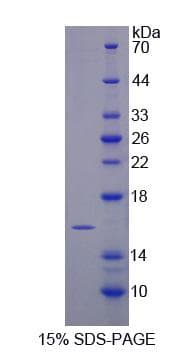 Mouse TMEM27 / Collectrin Protein (Recombinant His-S)