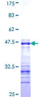 Human SHC2 / SLI Protein (Recombinant GST, N-terminus)