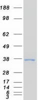 Human SMN1 Protein (Recombinant Myc-DDK (Flag))