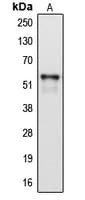 Polyclonal Rabbit anti-Human CYP2A6 Antibody (Internal, WB)
