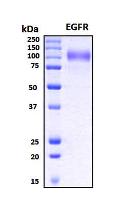 Human EGFR Protein (Recombinant 6His, N-terminus)