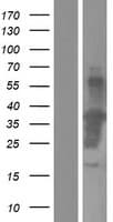 MTL5 / TESMIN Protein (Over-Expression Lysate Myc-DDK (Flag))