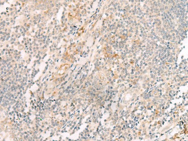 Polyclonal Rabbit anti-Human HBE1 / Hemoglobin Epsilon 1 Antibody (IHC, WB)