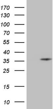SPC25 Antibody (clone OTI1F8)