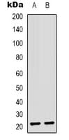 ASF1B Antibody (Internal)