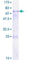 Human PDS5A Protein (Recombinant GST)
