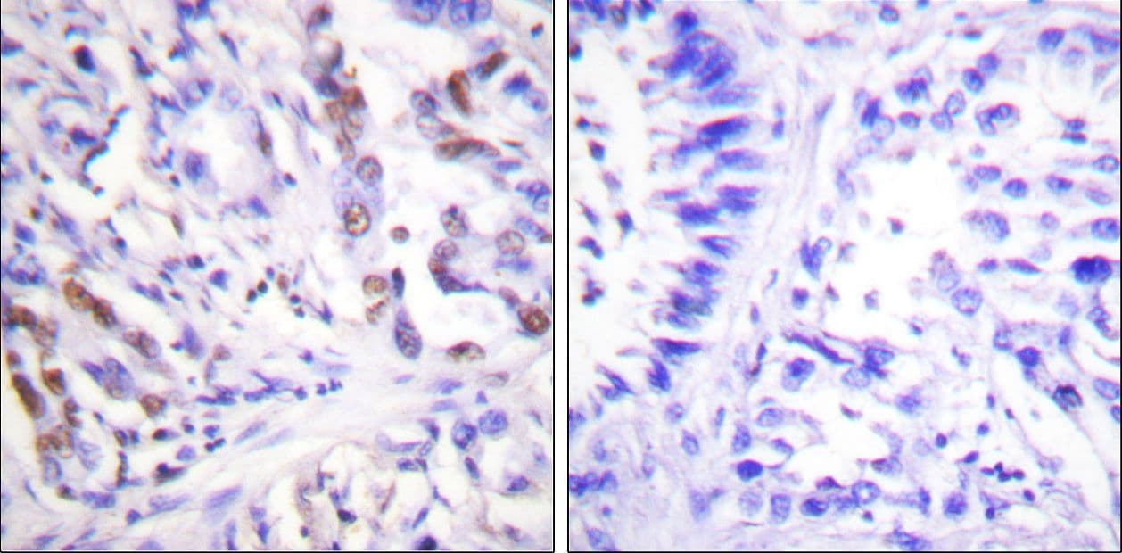 Polyclonal Rabbit anti-Human CDC25A Antibody (phospho-Ser75, IHC, WB)