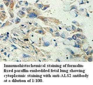 ALS2 / Alsin Antibody (aa177-414)