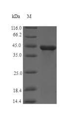 Clostridium botulinum fliC / Flagellin Protein (Recombinant 6His-SUMO, N-terminus)