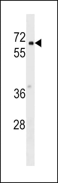 PYROXD2 Antibody (aa6-34)
