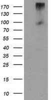 Monoclonal Mouse anti-Human GPR49 / LGR5 Antibody (clone OTI2H7, aa250-550, IHC, IF, WB)