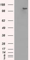 Monoclonal Mouse anti-Human BUB1B / BubR1 Antibody (clone OTI15E11, IHC, IF, WB)