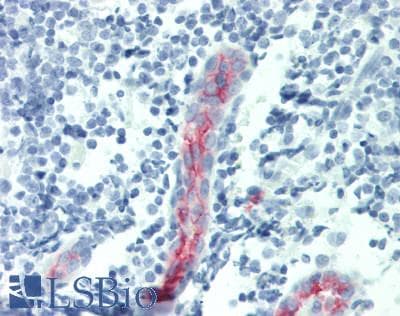 IHC-plus™ SELP / P-Selectin / CD62P Antibody (clone AK-6)