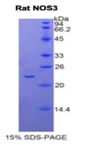 Rat NOS3 / eNOS Protein (Recombinant His)