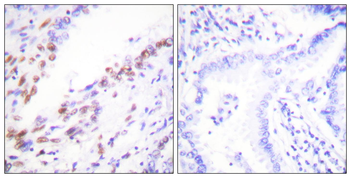 MKI67 / Ki67 Antibody