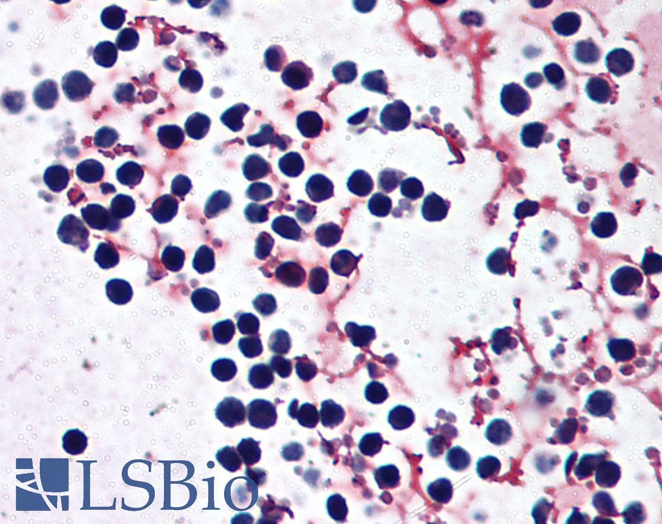 IHC-plus™ Polyclonal Goat anti-Human NALP3 / NLRP3 Antibody (aa82-93, IHC)