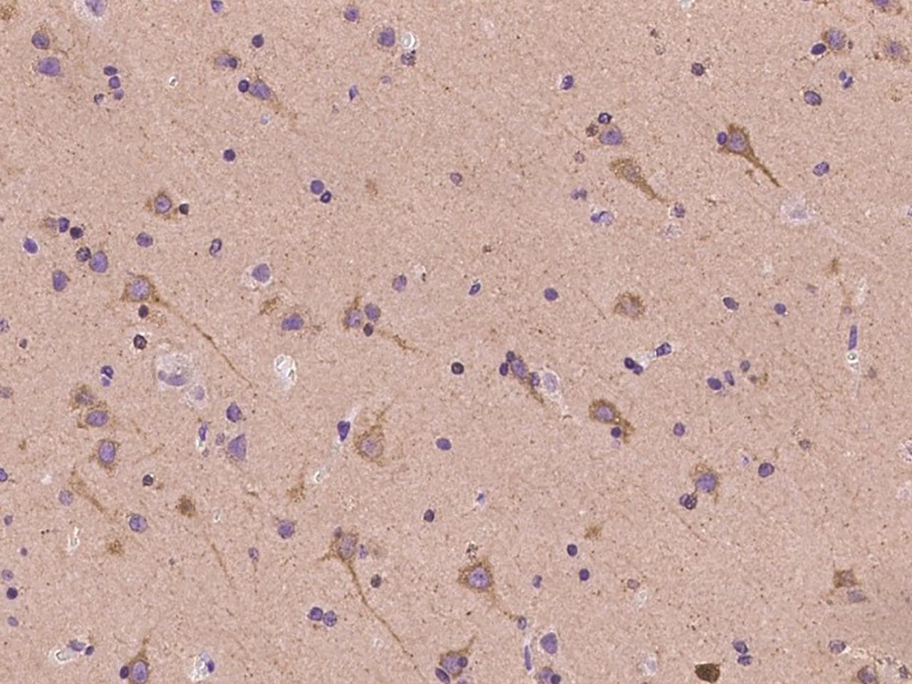 TYK2 Antibody
